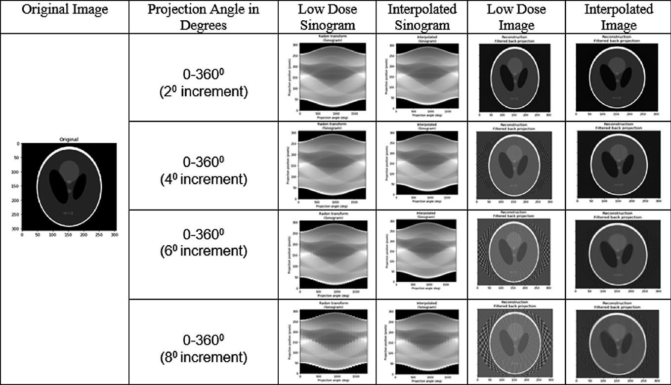 Low Dose Imaging Prediction Of Projections In Sinogram Space Springerlink