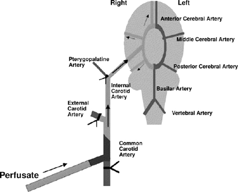 In Situ Brain Perfusion Technique Springerlink