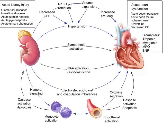 Cardiorenal Syndromes: Renal Artery Disease and Congestive Heart ...