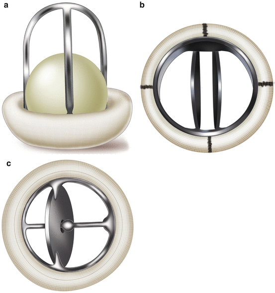 Prosthetic Heart Valves SpringerLink