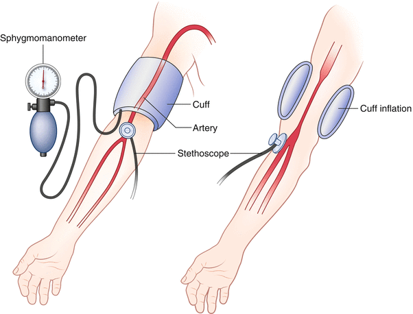 Patient Monitoring | SpringerLink