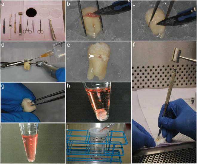 A Simplified and Systematic Method to Isolate, Culture, and