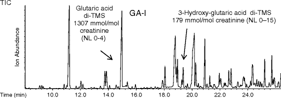 Identification of Urine Organic Acids for the Detection of Inborn ...