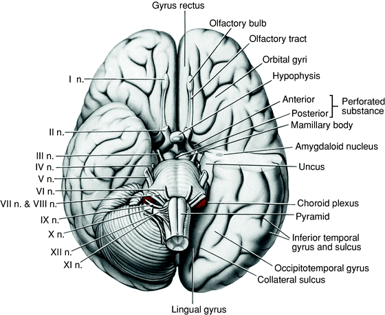 Which Cranial Nerve In The Diagram Has A Somatic Motor Function