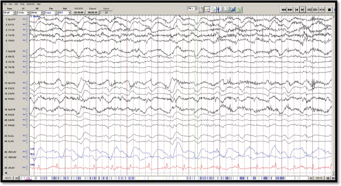 firda eeg firda eeg