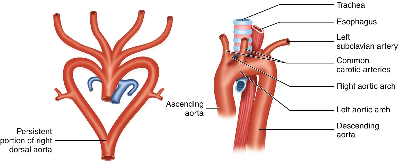 Anatomy Of Aorta - Anatomy Drawing Diagram