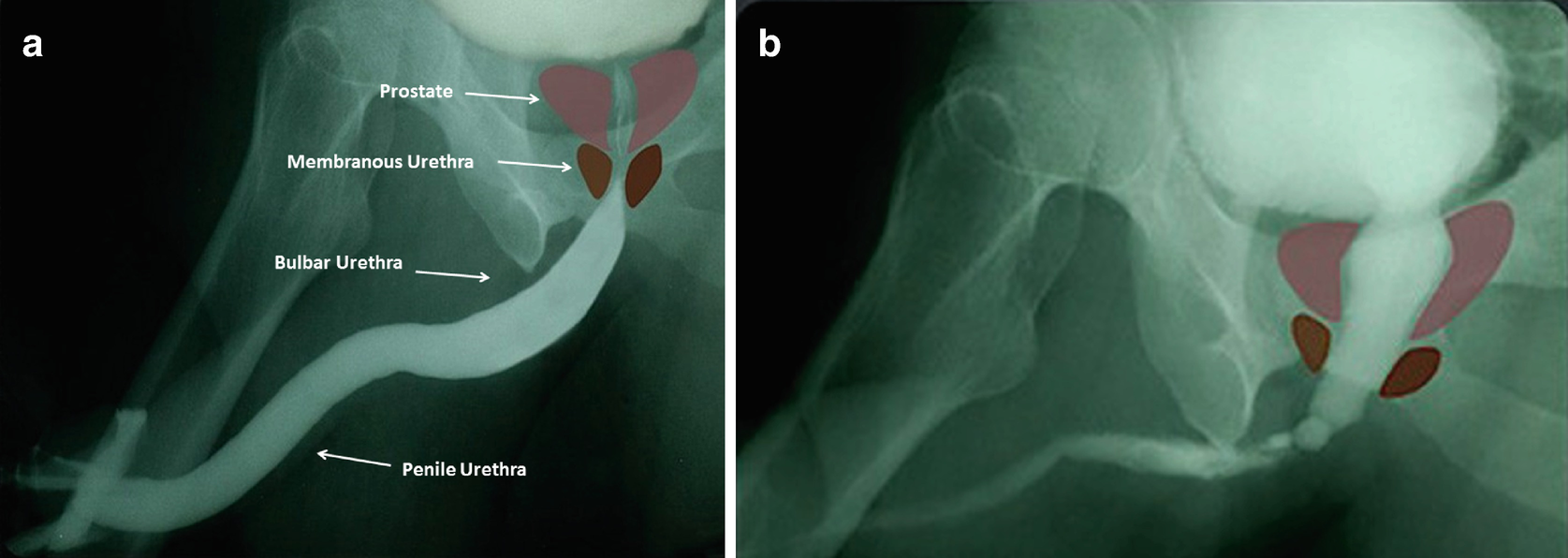 Functional Anatomy of the Male Urethra for the ...
