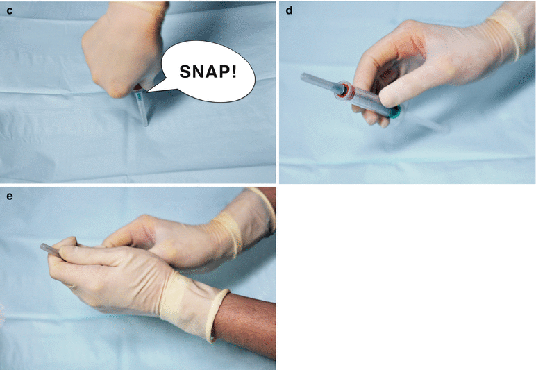 Injections SpringerLink