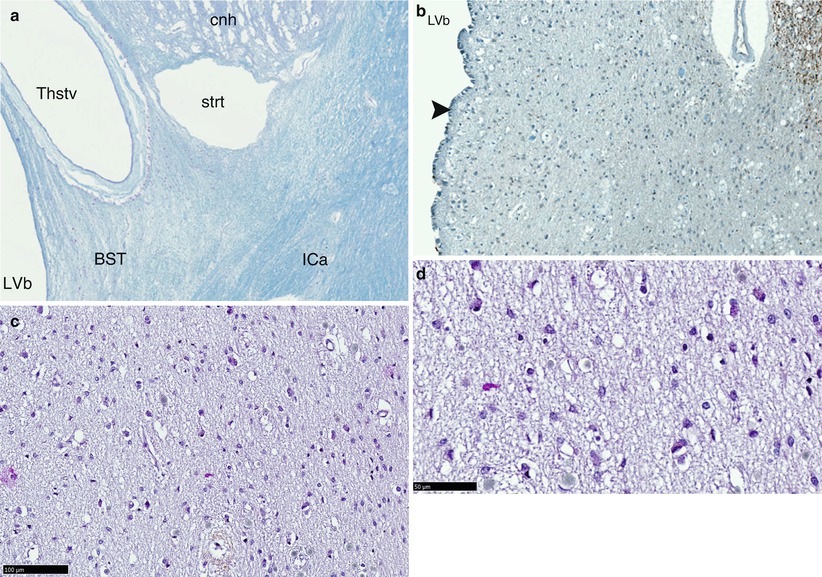 The Bed Nucleus of the Stria Terminalis SpringerLink