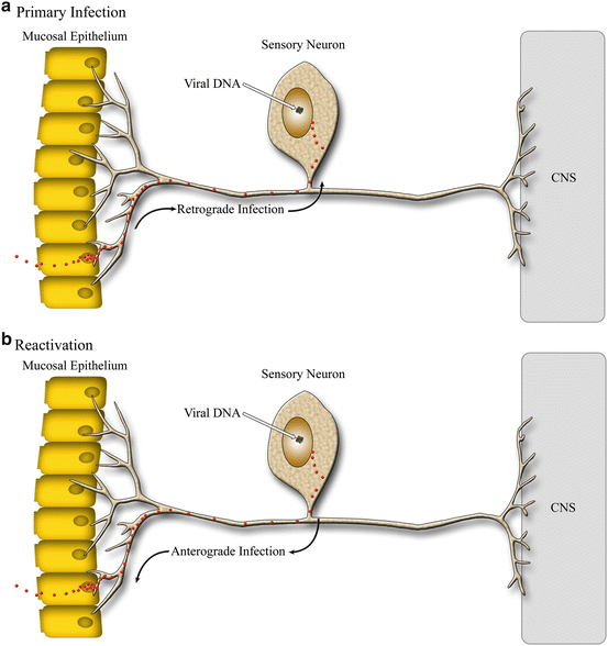 The Herpes Simplex Viruses SpringerLink