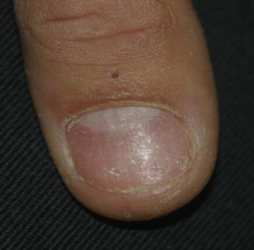 Mri Safety Nail Polish Nail Ftempo