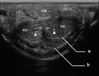 Penis: Ultrasound Anatomy and Scanning Methods | SpringerLink