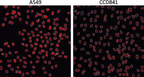 cellprofiler intensity segmentation cellprofiler intensity segmentation