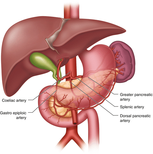 Splenic Artery Embolization for Non-surgical Splenectomy | SpringerLink