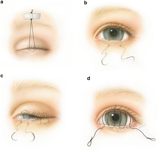 Basic Principles, Techniques, and Instruments SpringerLink