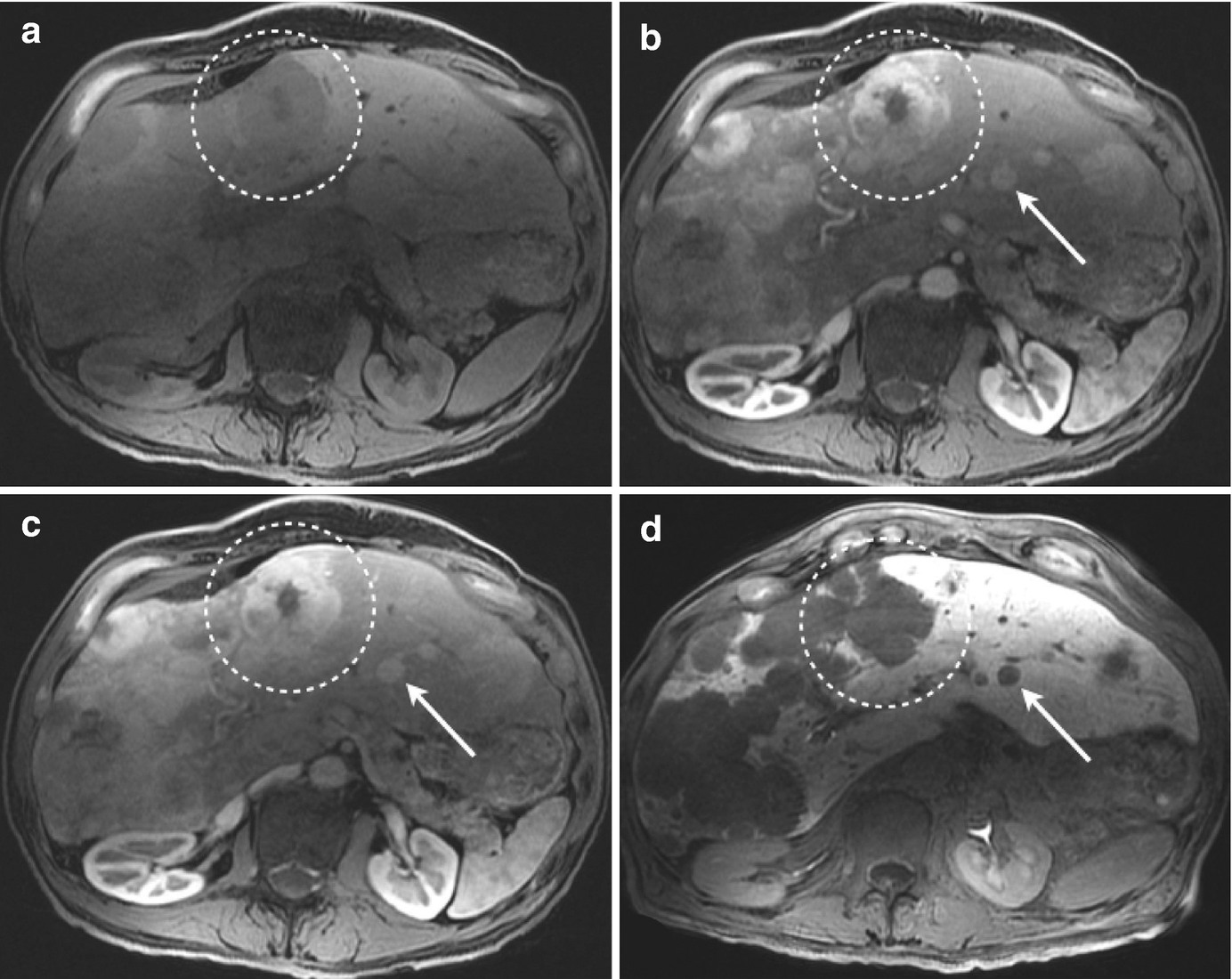 MRI Contrast Agents SpringerLink