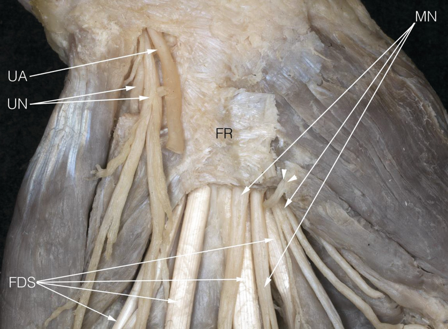 Gross Anatomy of the Human Hand | SpringerLink
