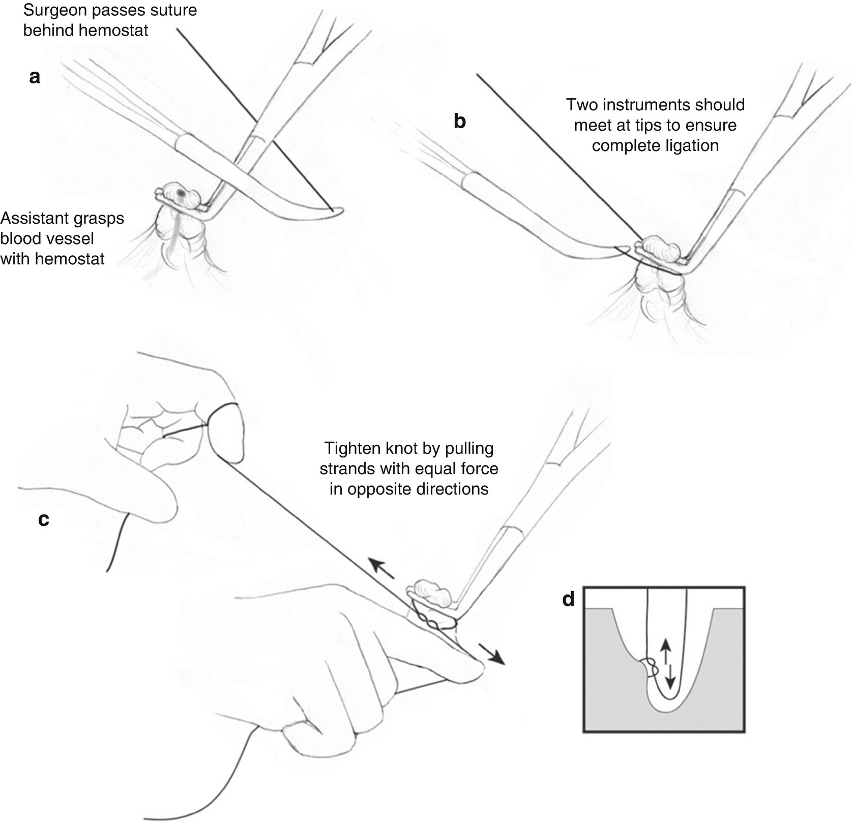 Fundamentals of Sutures, Needles, Knot Tying, and Suturing