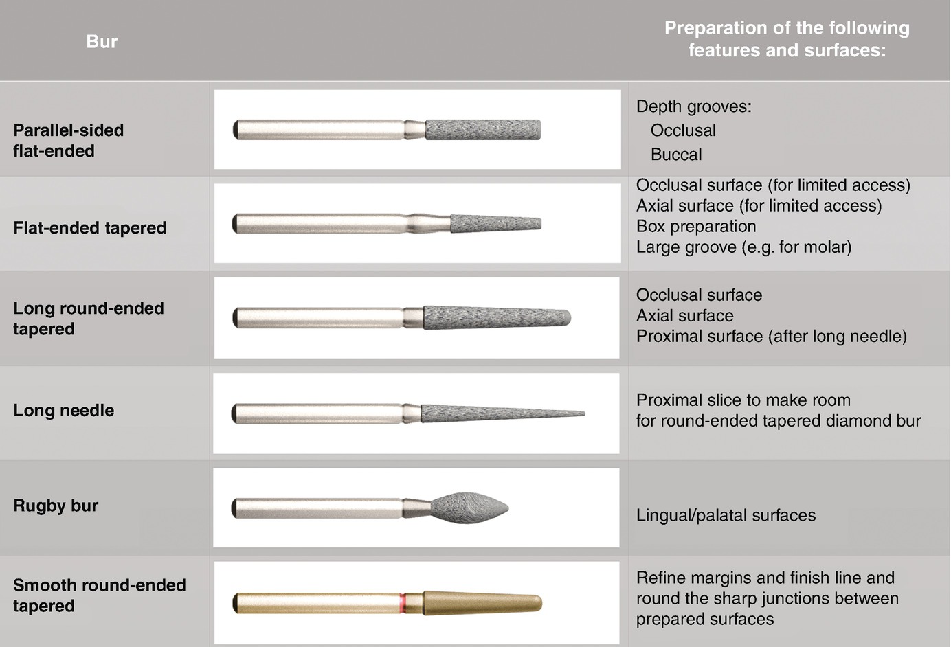 Fundamentals of Tooth Preparation SpringerLink