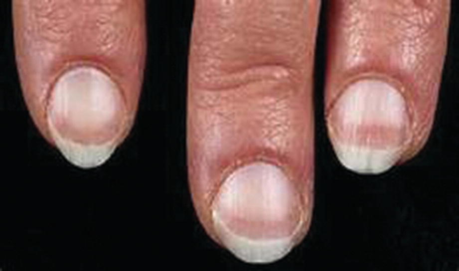 Terry Nails Treatment Nail Ftempo