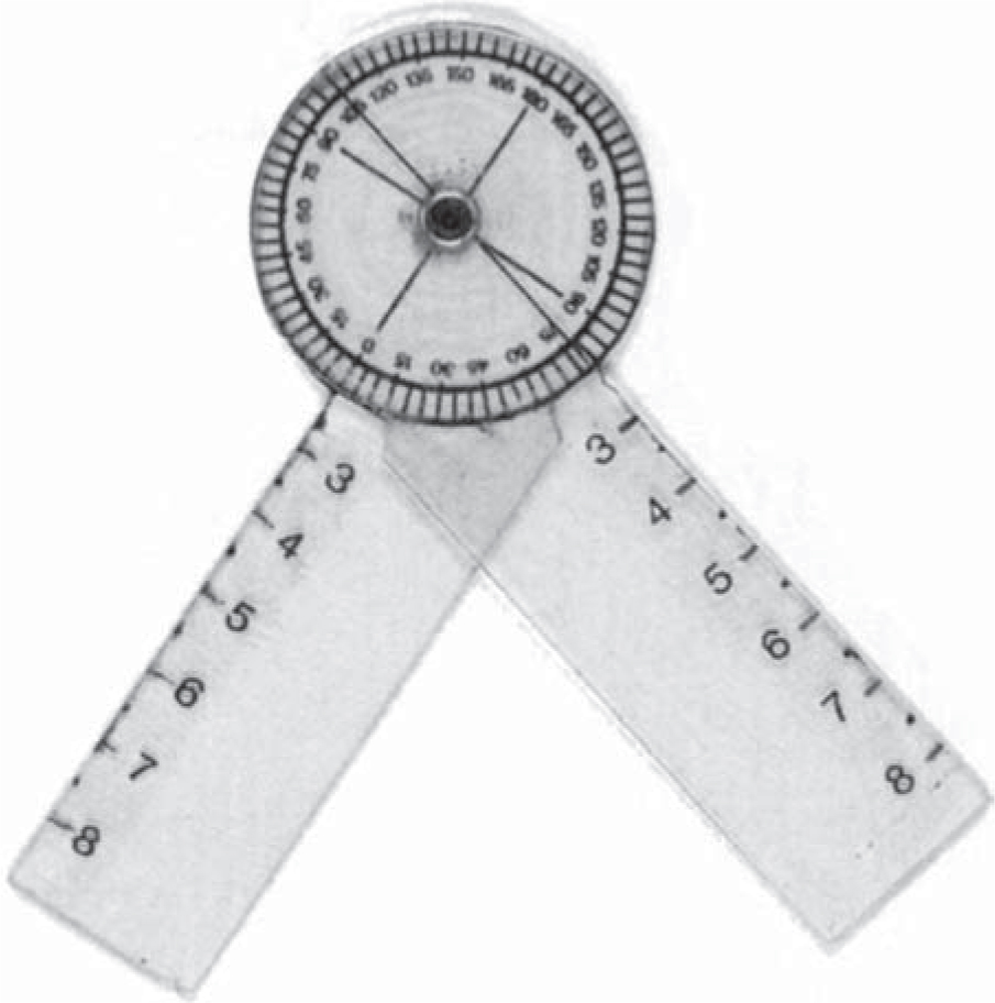 TemplateGoniometer for Marking the Wise Keyhole Pattern of Reduction