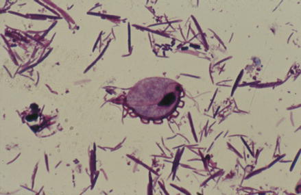 Trichomonas vaginalis | SpringerLink