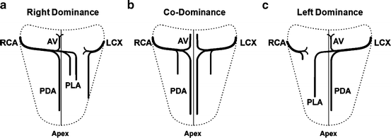 Diagnostic Coronary Angiography | SpringerLink