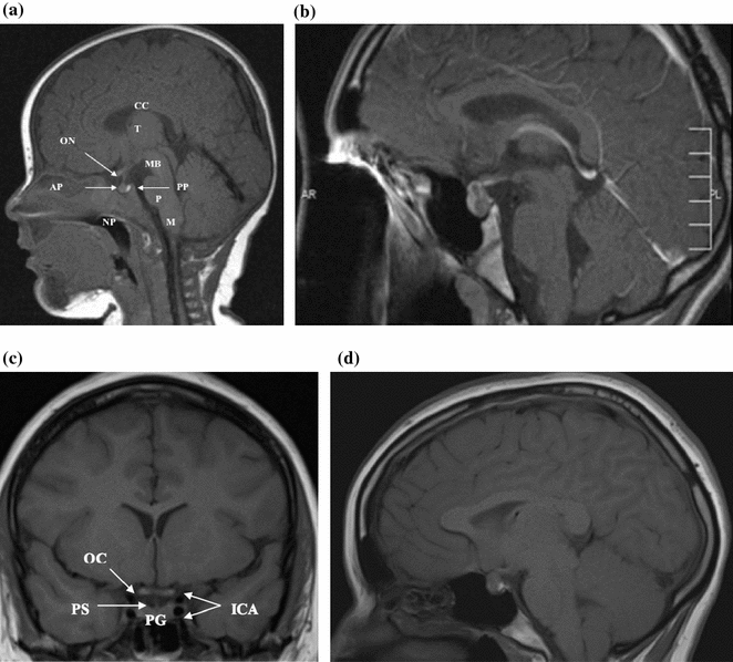Pituitary Gland Embryology, Anatomy and Physiology | SpringerLink