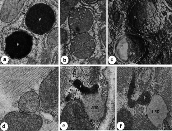 Peroxisome Interactions and Cross-Talk with Other Subcellular