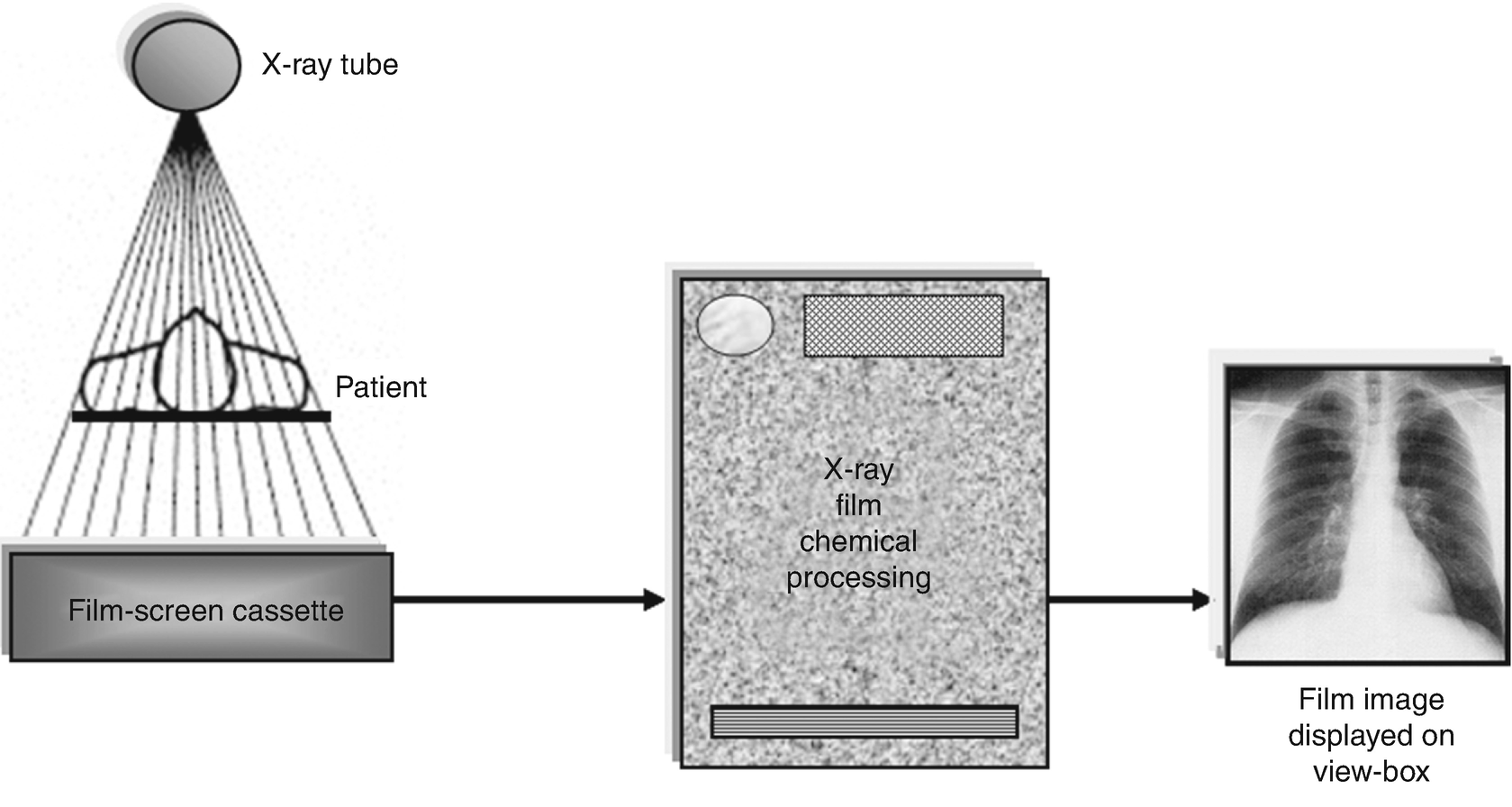 Wiring And Diagram Diagram Of X Ray Cassette
