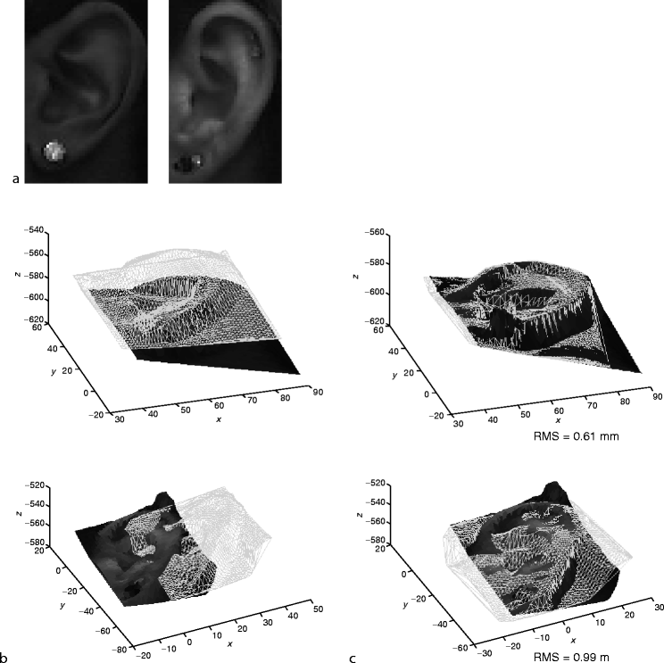 Ear Shape for Biometric Identification SpringerLink
