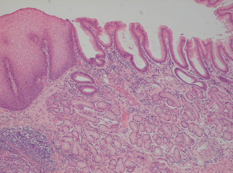 Gastric Cardia Histology