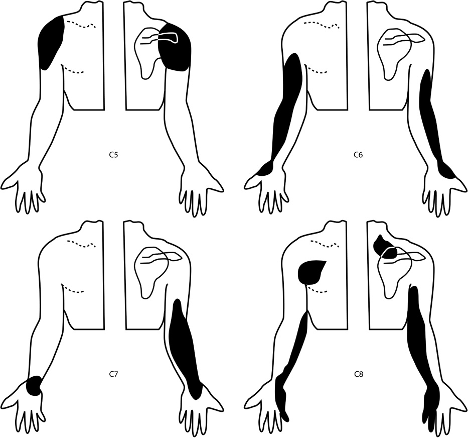 Visceral Referral Patterns Chart