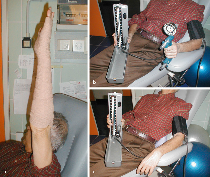 Tourniquet Test SpringerLink