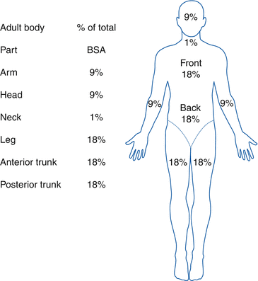 Burn Injury Rule Of Nines Springerlink