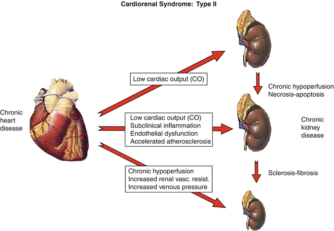Cardiorenal Syndrome | SpringerLink