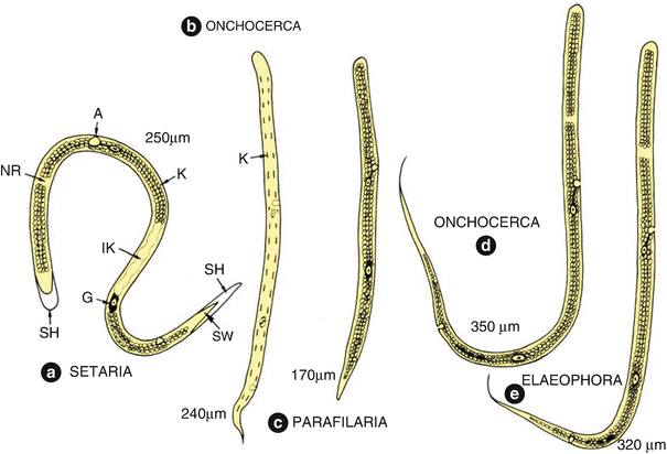 Microfilariae Springerlink