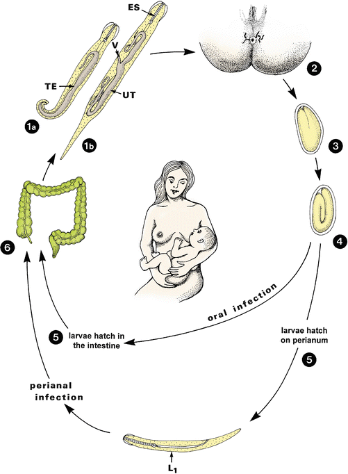 A pinworms enterobiosis