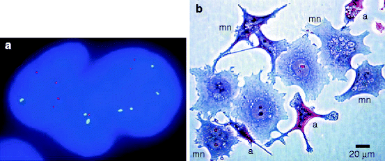 Mitotic Catastrophe Biology Diagrams
