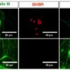 Ghrelin: a new therapeutic target for Parkinson’s?
