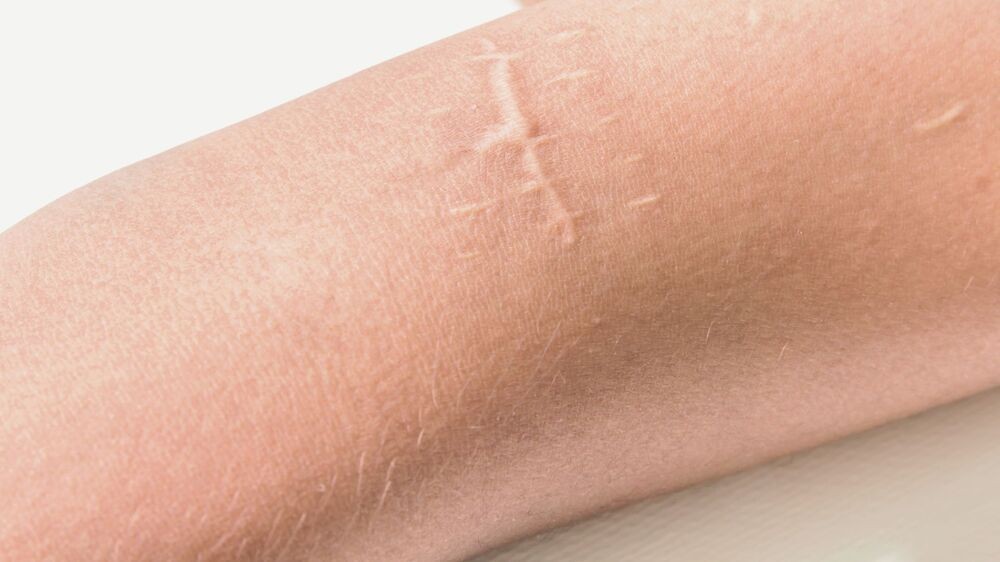 Vortrag Mikrobiom als Schutzfaktor