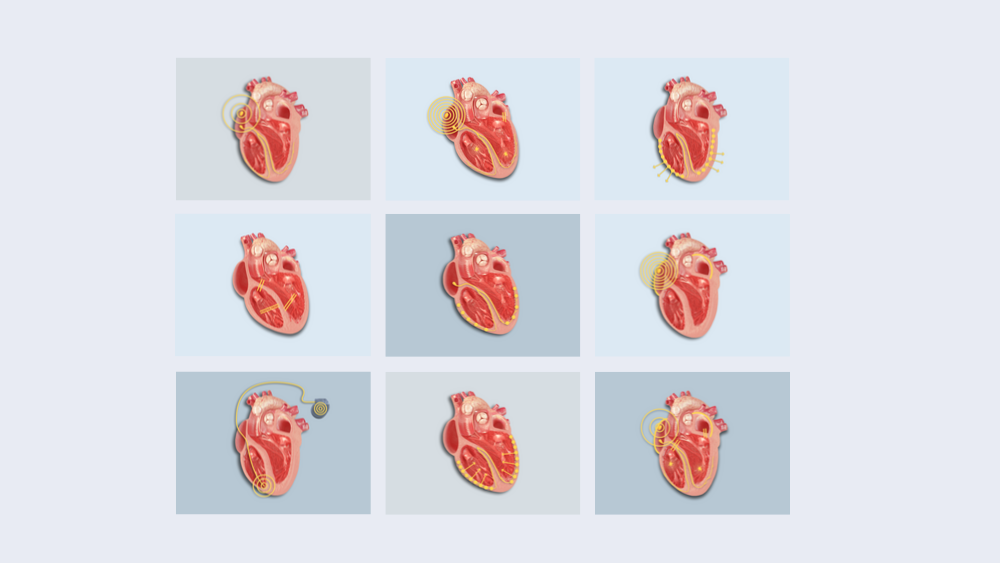 Case-Based Insights teaser image