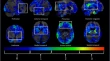 neurology research articles