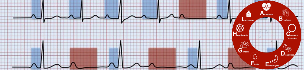 Teaserbild ABC des EKGs