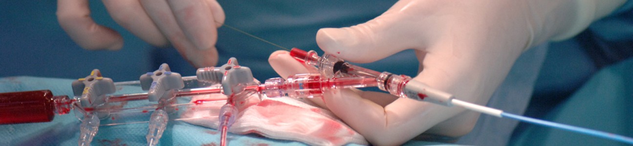 Elektrophysiologie im OP