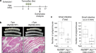 Bcl9 and Pygo synergise downstream of Apc to effect intestinal neoplasia in  FAP mouse models