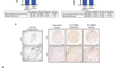 PDF) ECT2 associated to PRICKLE1 are poor-prognosis markers in  triple-negative breast cancer