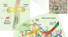 Stroke subtype-dependent synapse elimination by reactive gliosis in mice