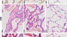 Lung extracellular matrix modulates KRT5+ basal cell activity in pulmonary  fibrosis