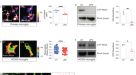 Stroke subtype-dependent synapse elimination by reactive gliosis in mice